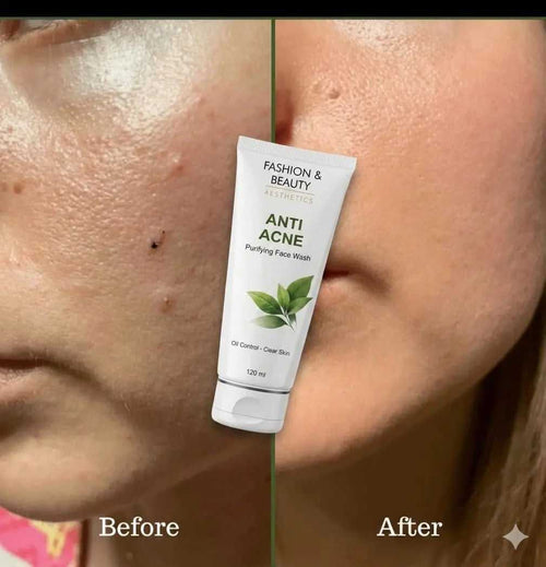 ANTI ACNE PURIFYING FACE WASH 120ML 40 399 Rs. FACE WASH Home page Fashion and Beauty Aesthetics Fashion and Beauty Aesthetics